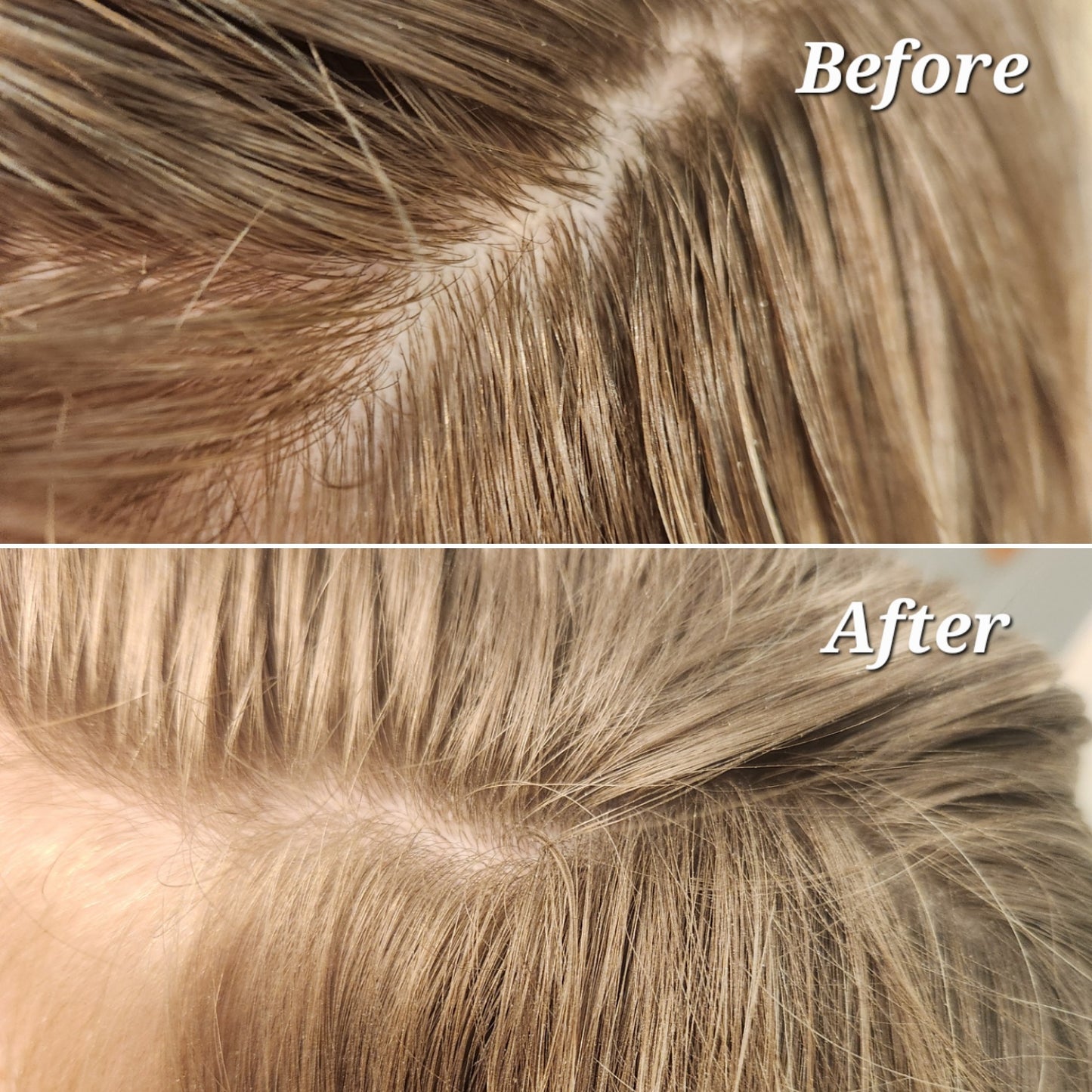 Dry Shampoo